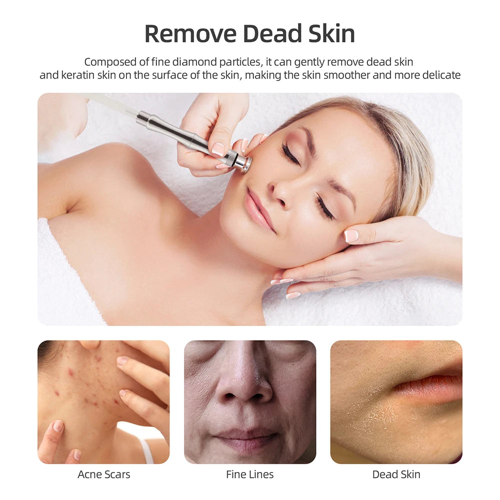 Foreverlily Spa Facial Peeling Deep Cleansing Pore Device