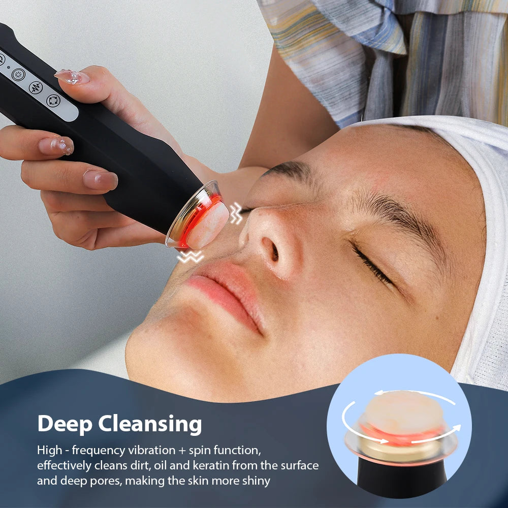 Foreverlily Oxygen Bubble Pen CO2 Facial Machine Skin Care