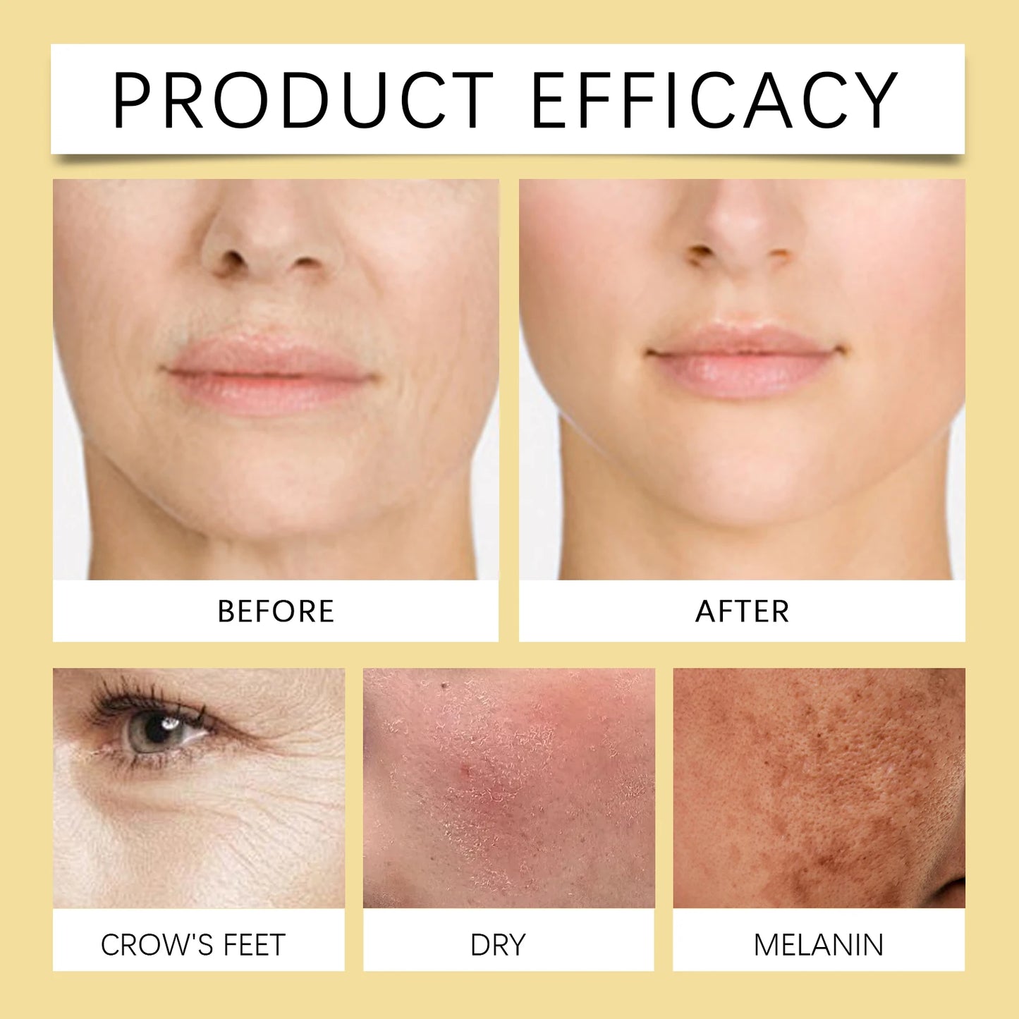 Hoygi Bee Venom Cream Instant Lifting Tightening And Wrinkle Reduction