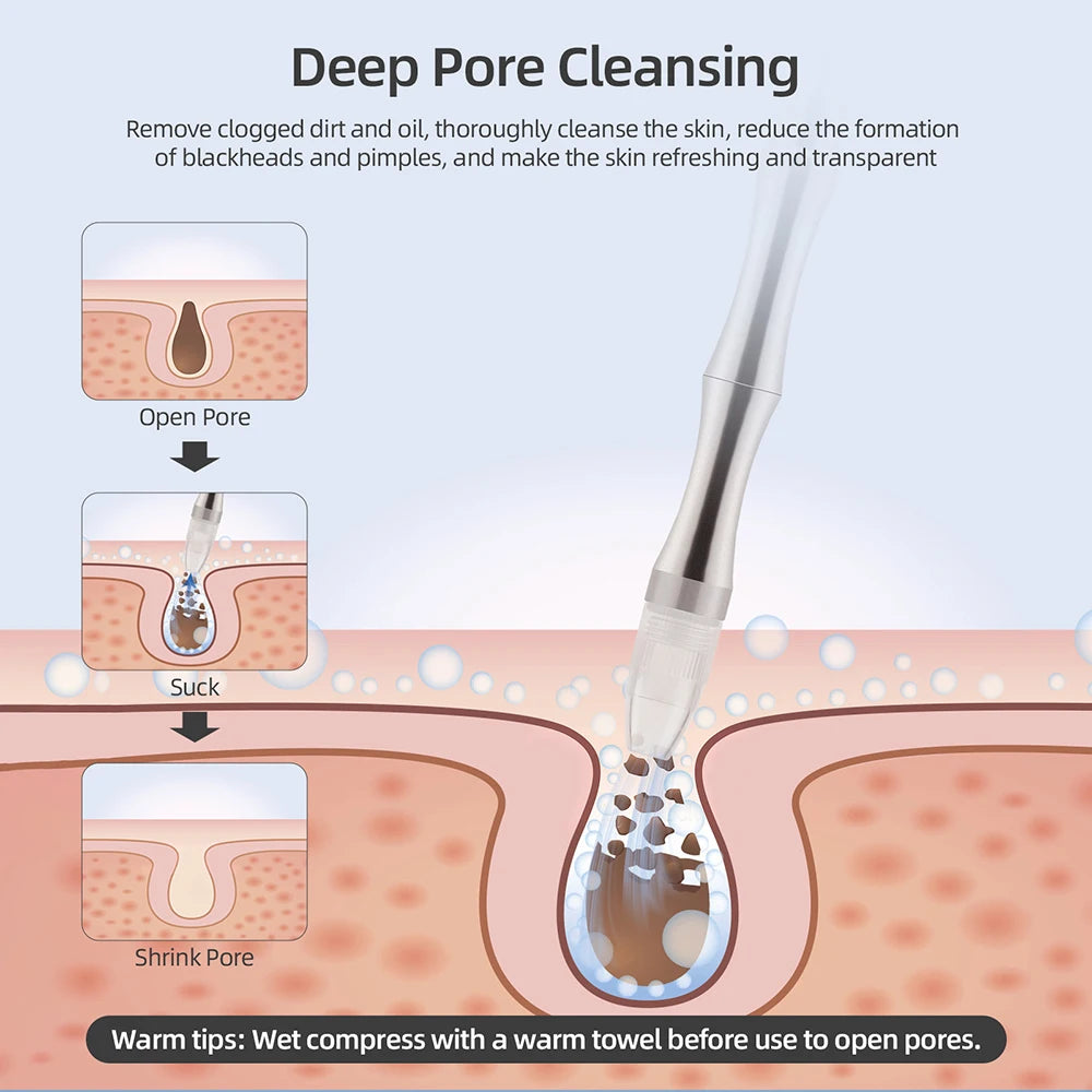 Foreverlily Spa Facial Peeling Deep Cleansing Pore Device